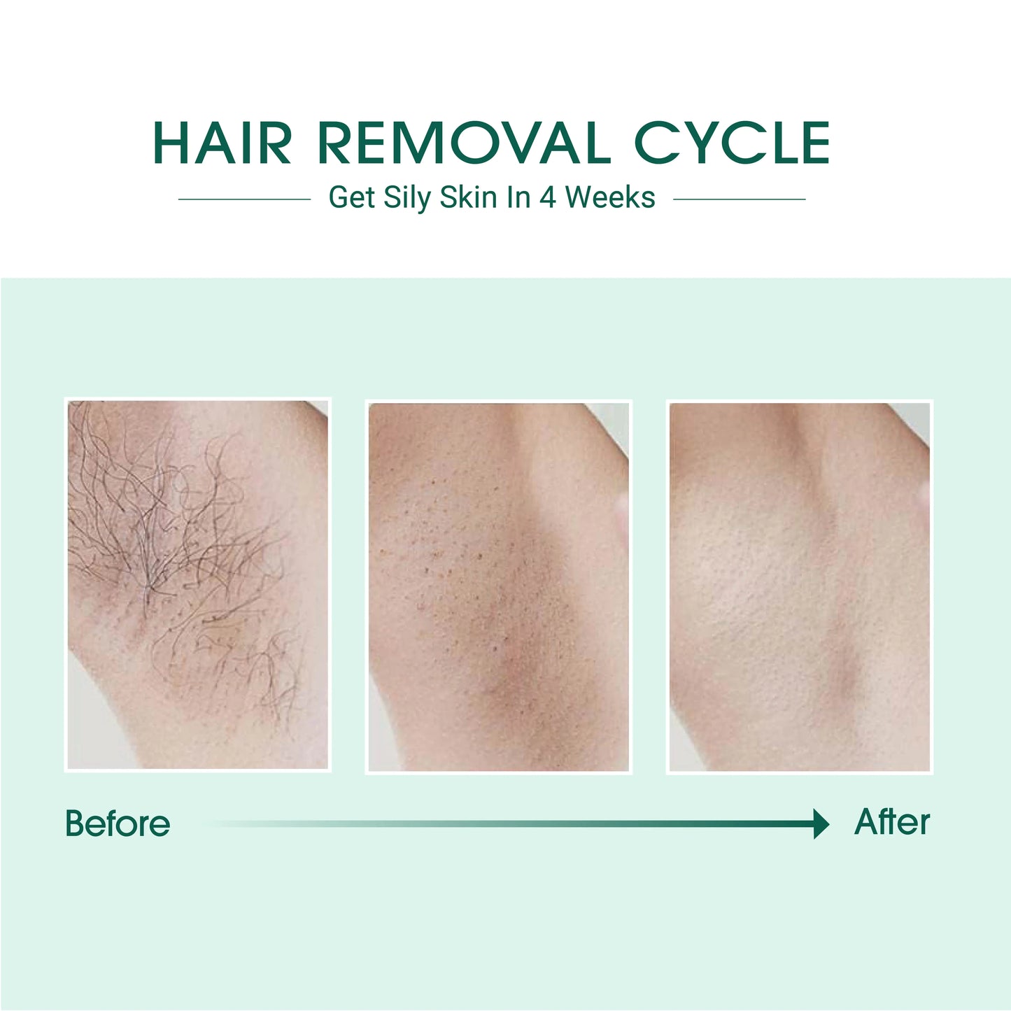 LumiClear Hair Removal